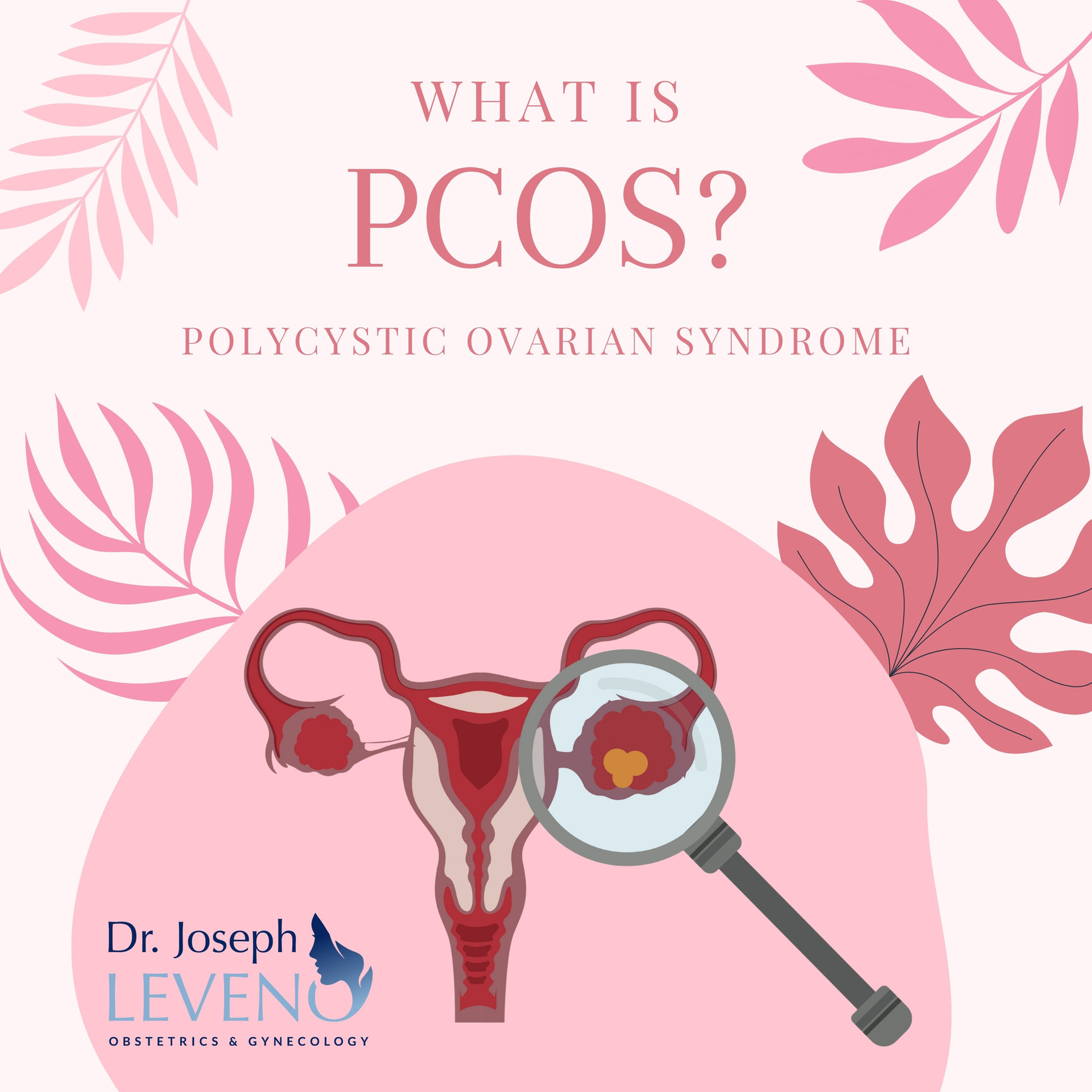 What Is Pcos Polycystic Ovarian Syndrome Dr Joseph Leveno