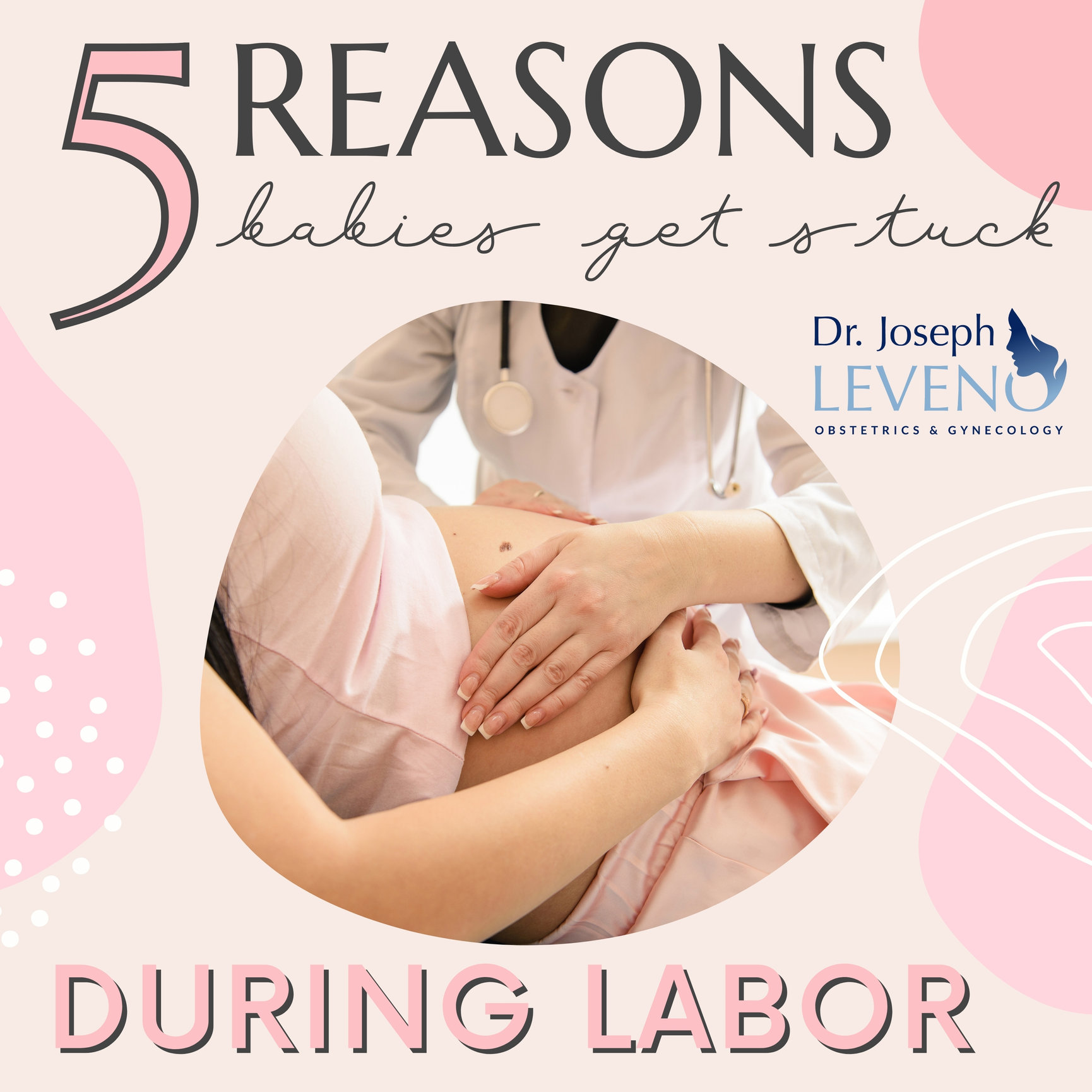 5ReasonsBabiesGetStuckDuringLabor Dr. Joseph Leveno