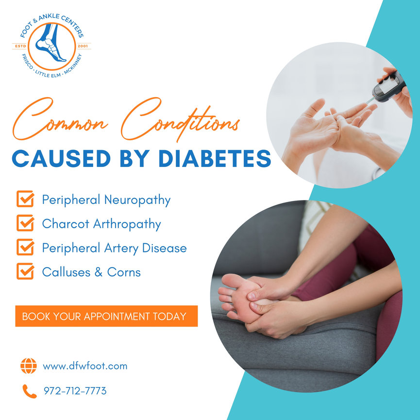 Common Conditions Caused By Diabetes and Treatment in Frisco, Little ...