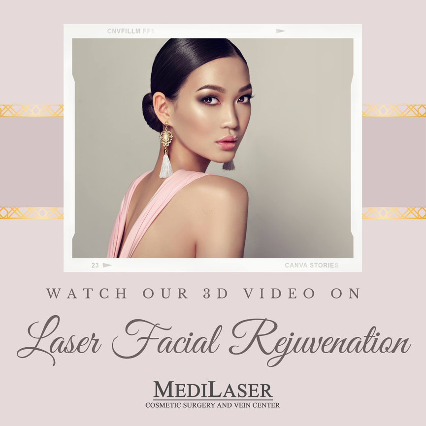 3DVIDEOLASERFACIALREJUVENATIONMASKNE Medilaser Surgery and Vein